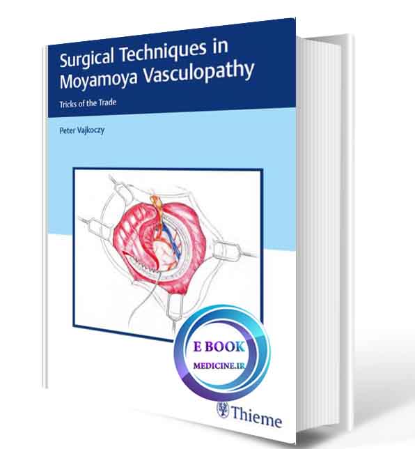 دانلود کتابSurgical Techniques in Moyamoya Vasculopathy: Tricks of the Trade  2020(ORIGINAL PDF)  